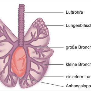 Home Remedies - COPD: Treating Chronic Obstructive Pulmonary Disease