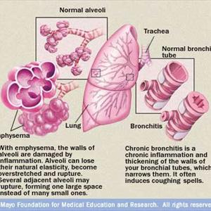 Holistic Lung Doctors 