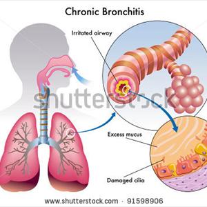 Puffers For Bronchitis - Bronchitis Firm And Information To Manage This Kind Of Disorder